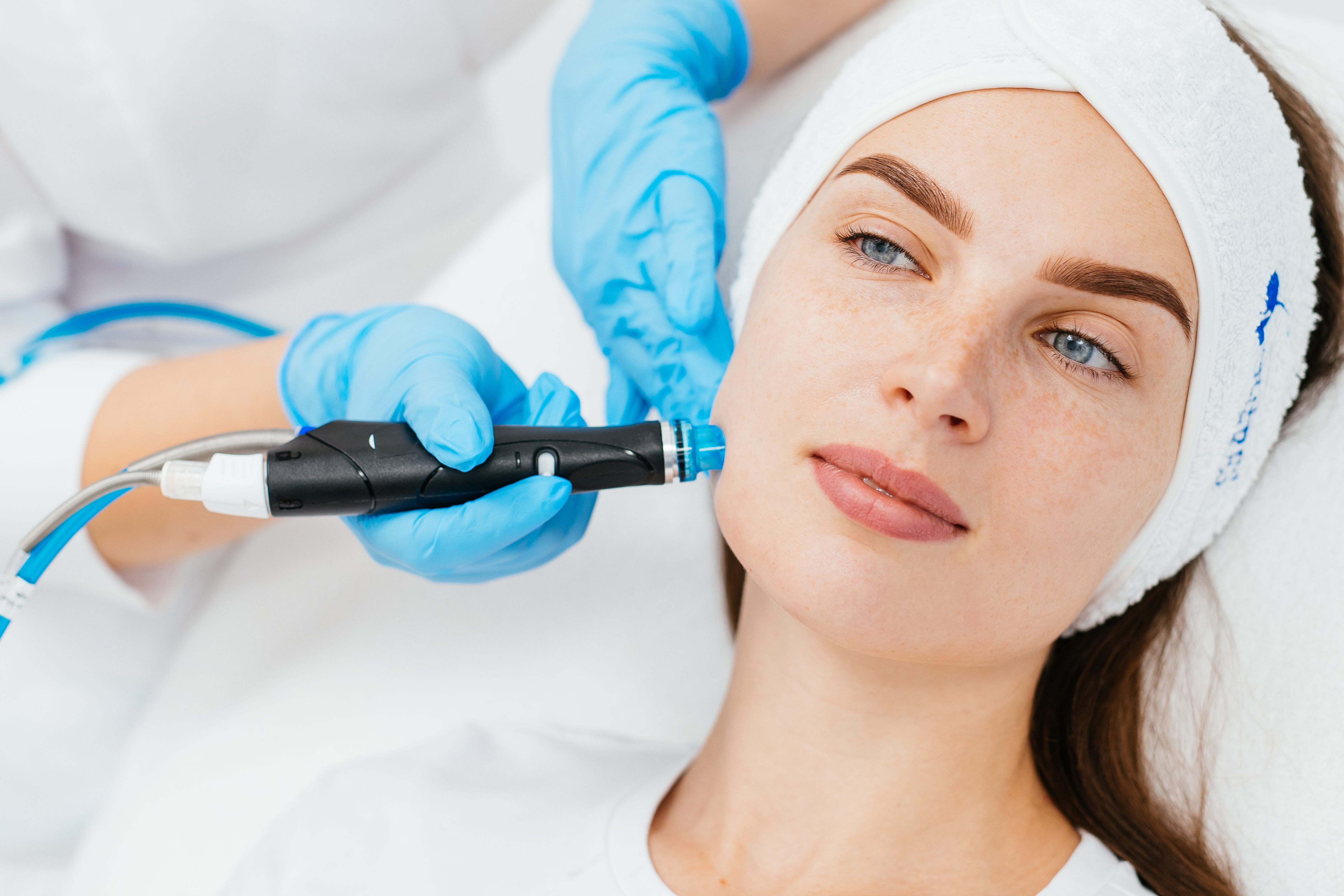 Microneedling Behandlung